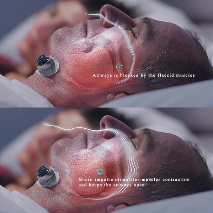 Smart Anti-Snoring Device Electronic Muscle Stimulator Dream Tech Sleep