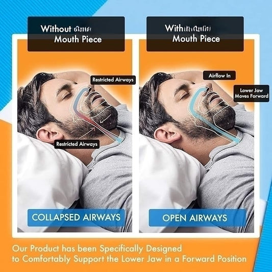 Stop Snoring Mouthpiece | Anti Snore Guard for Apnea & Bruxism Relief Dream Tech Sleep