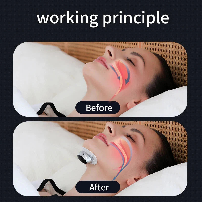 New Smart Anti Snoring Device Stop Snoring Dual Pulse Muscle Stimulator Anti Sleep Snoring Breathing Corrector Health Care Dream Tech Sleep