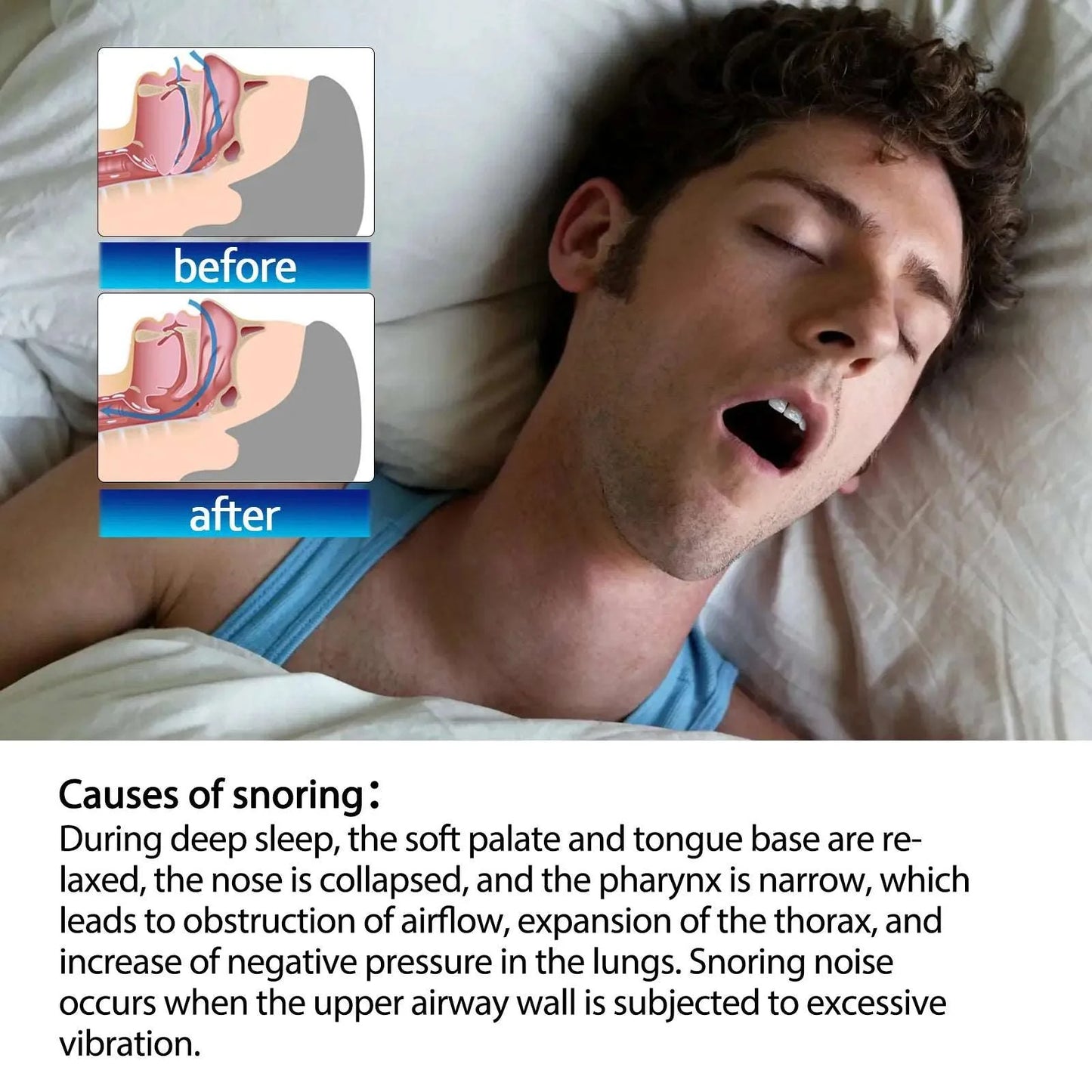 Breathe Nasal Strips | Stop Snoring, Prevent Mouth Opening Dream Tech Sleep
