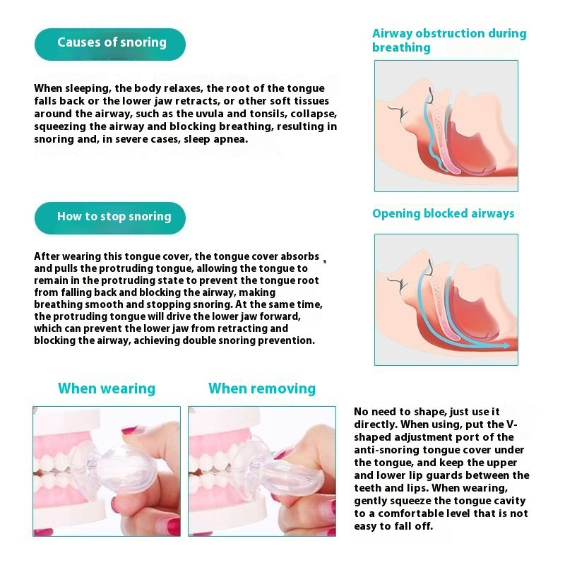 Anti-snoring Device Tongue Case Silicone Anti-snoring Respirator Sleeping Aid Instrument Resistance  My Store
