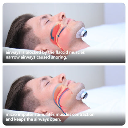 Smart Anti Snoring Device Electronic Muscle Stimulator Plus With 20pcs Conductive Strips  My Store
