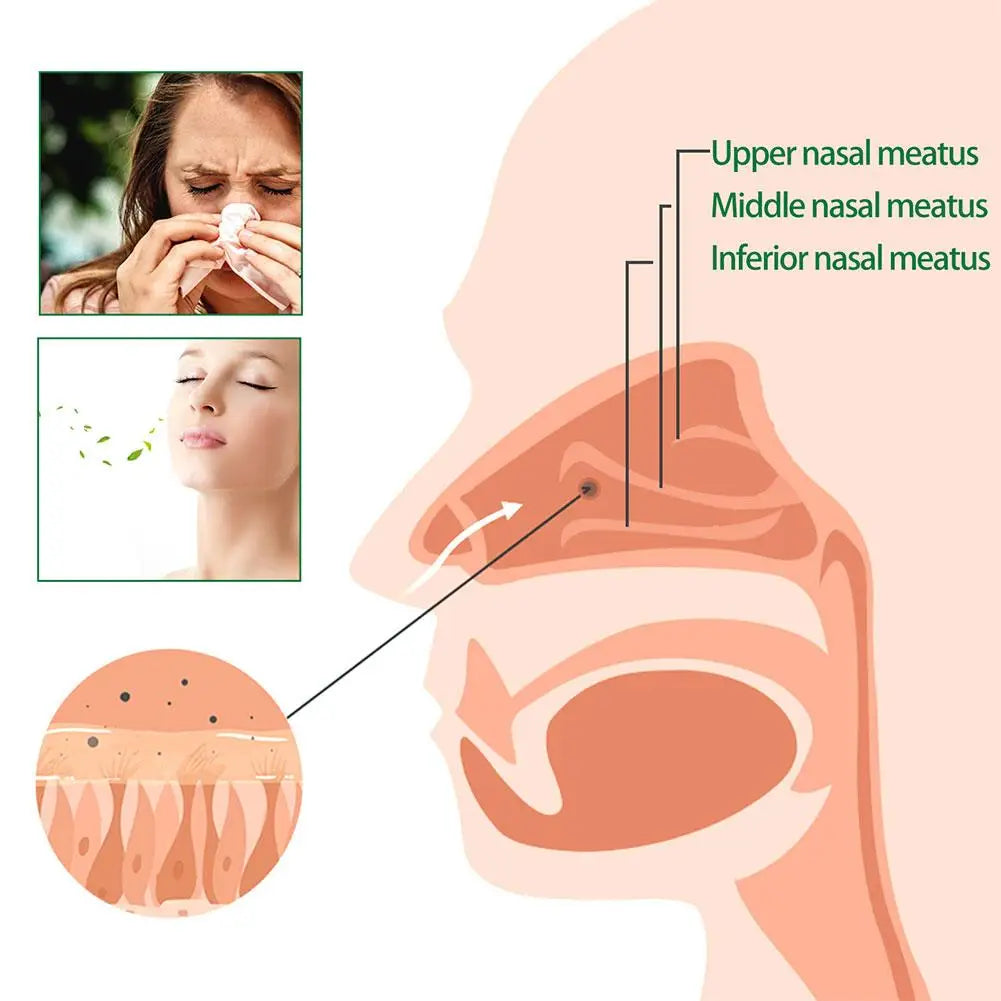 Lung Detox Herbal Cleanser Spray | 20ml Anti Snoring Solution  Dream Tech Sleep