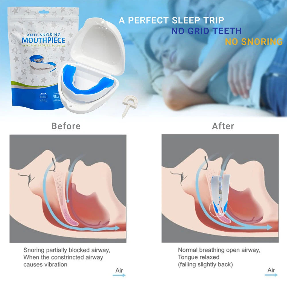 Anti Snoring Bruxism Mouth Guard Snoring Prevention Sleeping Aid Apnea Guard Teeth Device Mouthpiece Anti Snore Stop Mouth Guard  My Store