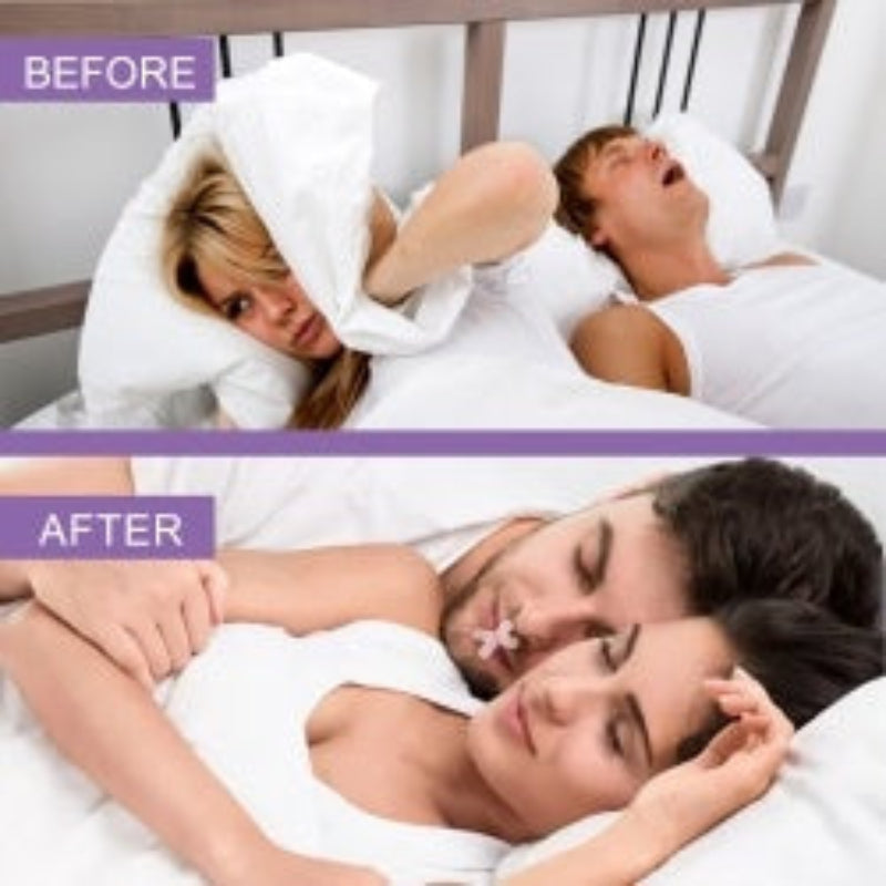 Sleep Anti-Snoring Tape, Open Mouth Breathing Physical Expansion Pamper Sleep Anti-Snoring Patch  Dream Tech Sleep