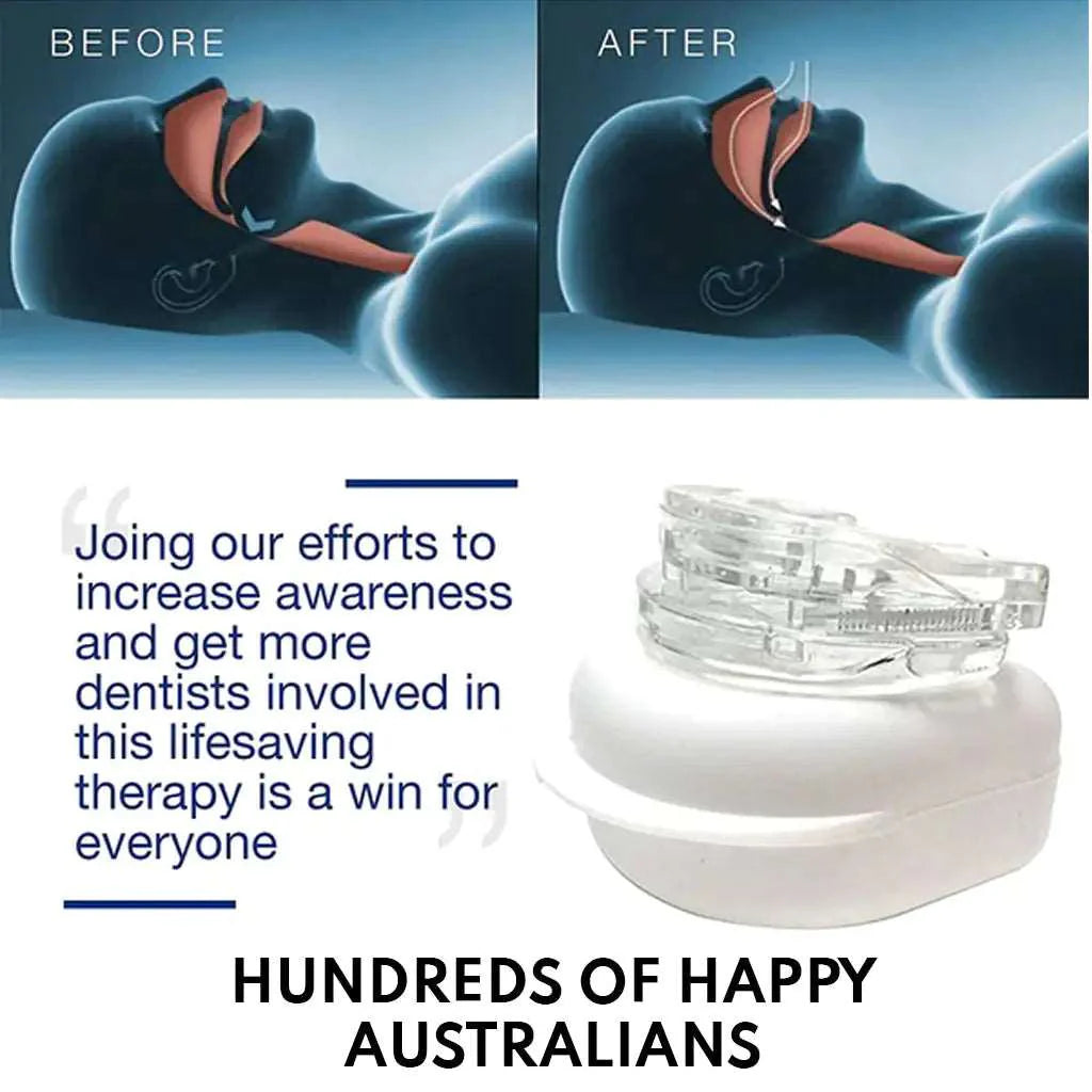 Anti-Snoring Mouthpiece Sleep Guard  Dream Tech Sleep